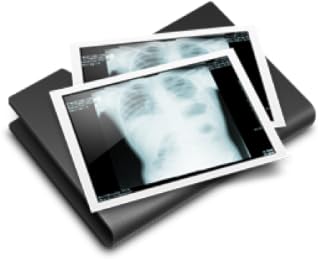Dicom Viewer