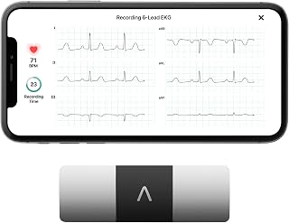 KardiaMobile 6L 6-lead EKG Heart Monitor, Medical-grade accuracy, HSA&FSA