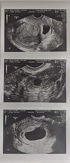 Prank 2D Customized Fake Ultrasound Strip of 3 Photos